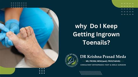 Understanding Your Hallux Rigidus Diagnosis - Dr KP Meda