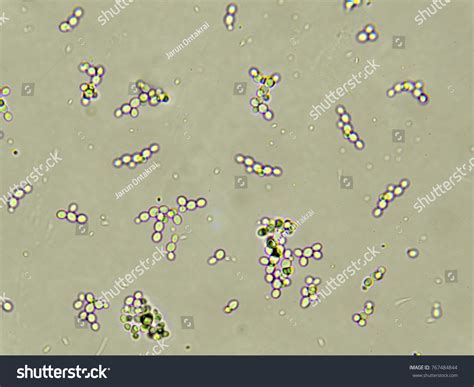 Yeast budding 현미경: 789개가 넘는 로열티 프리 라이선스 대상 스톡 사진 | Shutterstock