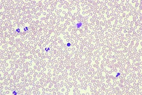 Photo Gallery - Dr.K.Raghu