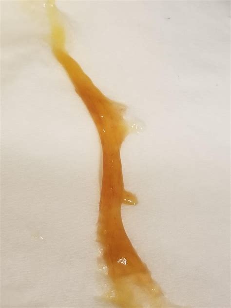 20F, 110Lbs, 5'4, Orange/Yellow Mucus in Stool? Recurring Problem. : r/AskDocs
