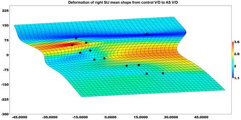 Evaluation of Sacroiliac Joint Shape in Women with Ankylosing ...
