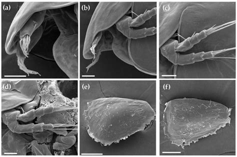Cladocera (Crustacea: Branchiopoda) of Man-Made Lakes at the Northeast ...