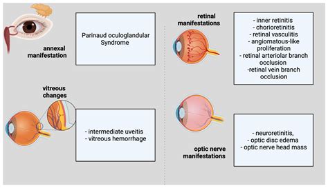 Parinaud Oculoglandular Syndrome
