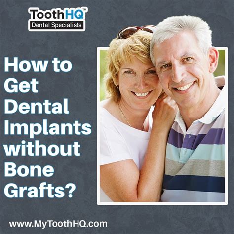 All-on-Four Immediate Function Treatment with NobelActive Implants , ToothHQ Board Certified ...