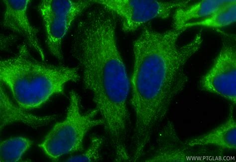 NMT1 antibody (67984-1-PBS) | Proteintech