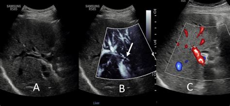 Image result for Ultrasound Lab