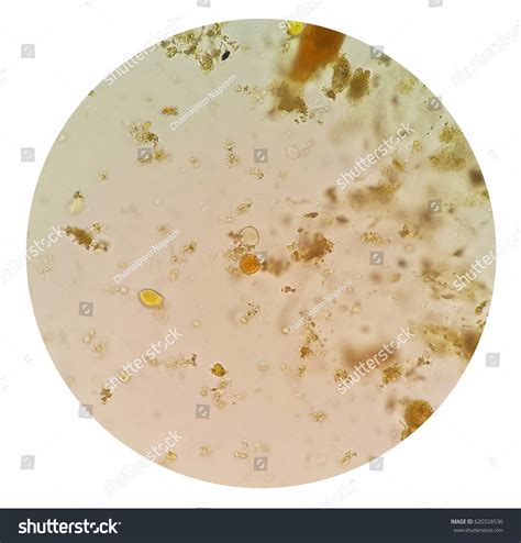 Stool Examination Test Parasites Eggs StoolẢnh có sẵn620328536 | Shutterstock