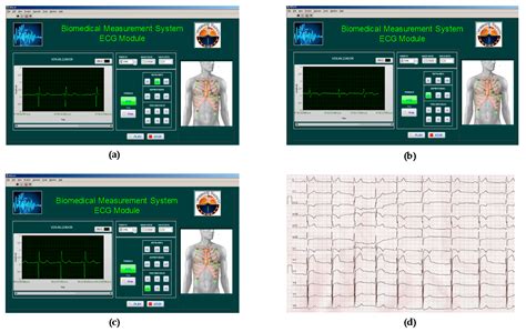 Implementation of a Cost-Effective Didactic Prototype for the ...