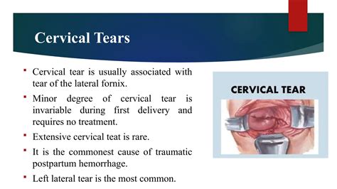 Injuries to birth canal- Obstetrics and gynaecological nursing | PPTX
