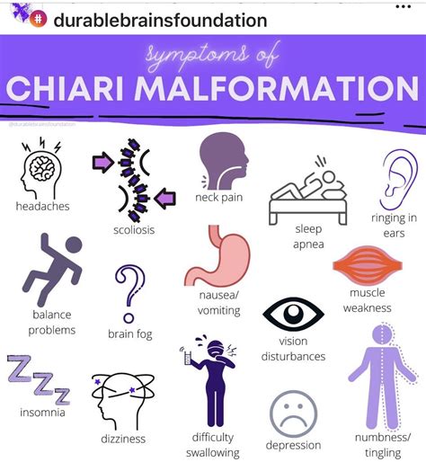 Chiari exercise guide – Artofit