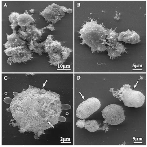 Ultrastructural Study of Acanthamoeba polyphaga Trophozoites and Cysts ...