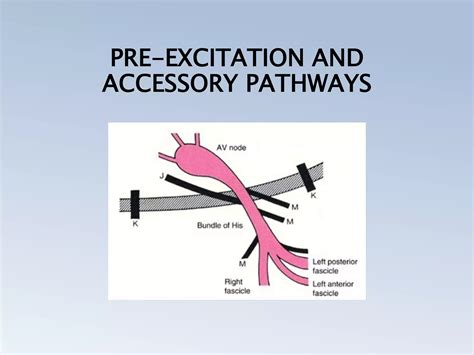 PRE EXCITATION SYNDROMES (THE WOLFF PARKINSON WHITE, LPL, MAHAIM) | PPTX