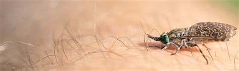 Image result for Insect Removal From Humans