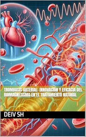 Trombosis Arterial: Innovación y Eficacia del Biomagnetismo en el ...