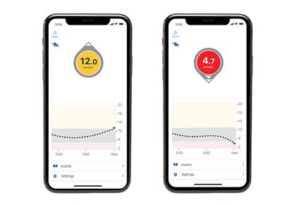 Image result for Dexcom Update
