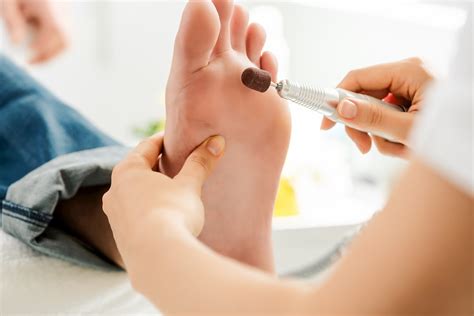 Common Reasons to see a Podiatrist - Active Care Podiatry
