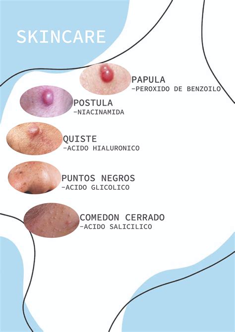 ¿Qué es mejor para el acné? 🔥 Niacinamida vs. Peróxido de benzoilo | Productos para el acné ...
