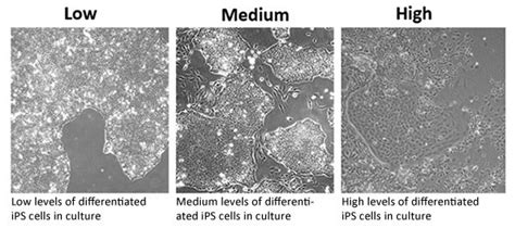 Induced Pluripotent Stem Cell Culture Protocols