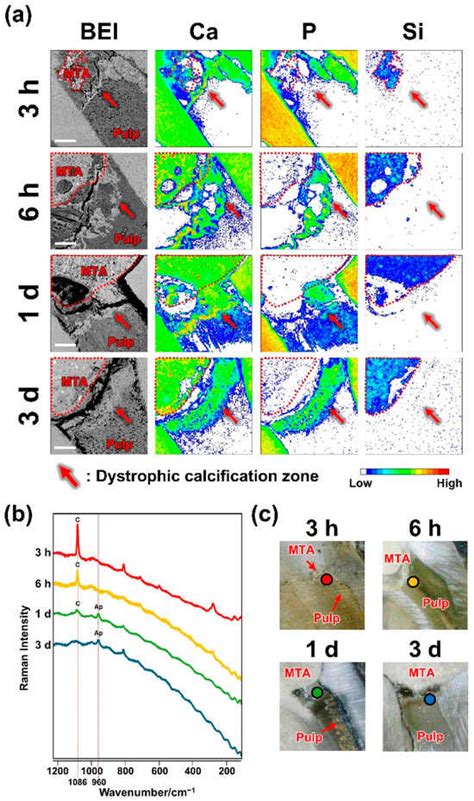 Role of Dystrophic Calcification in Reparative Dentinogenesis After Rat ...