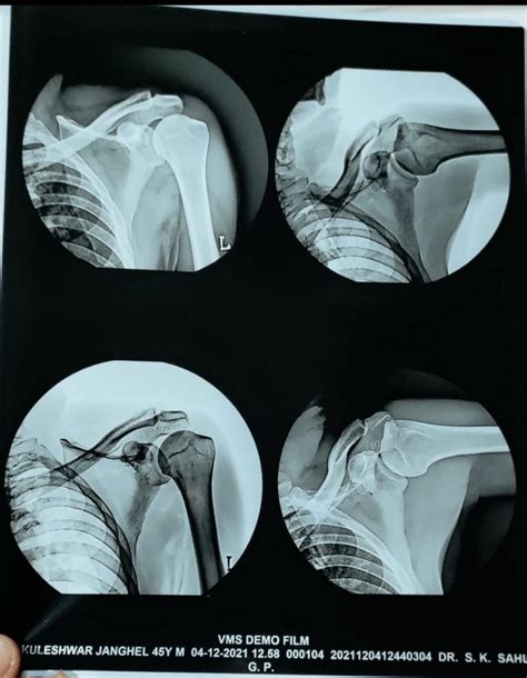 Epson inkjet X-Ray Film Printer With Dicom Software For Hospital With ...