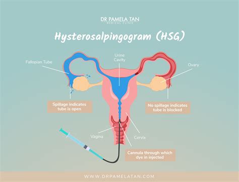 Unlocking Parenthood: Infertility Diagnosis and Solutions