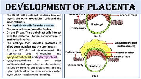 Placenta Development Notes Anatomy 的图像结果