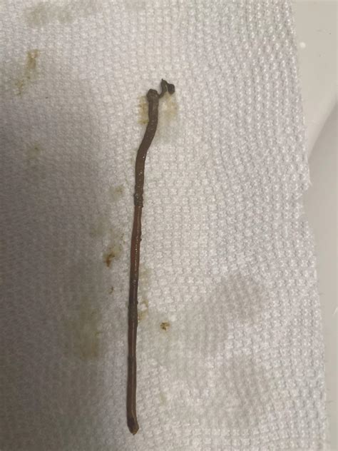 What Do Tapeworms In Human Stool Look Like