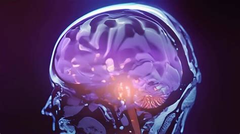 Image result for Exploding Brain Royalty Free