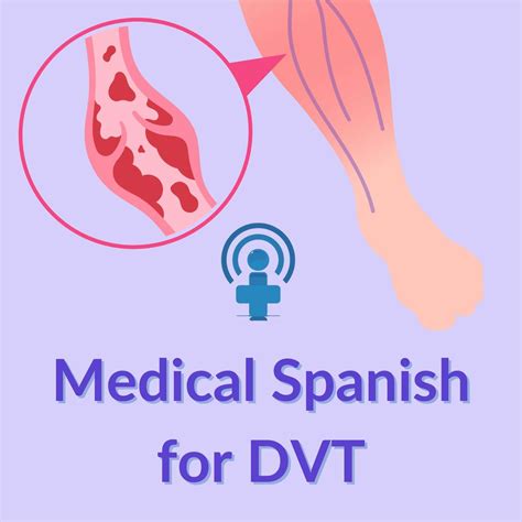DVT Risk Factors in Spanish | Medical Spanish Lesson