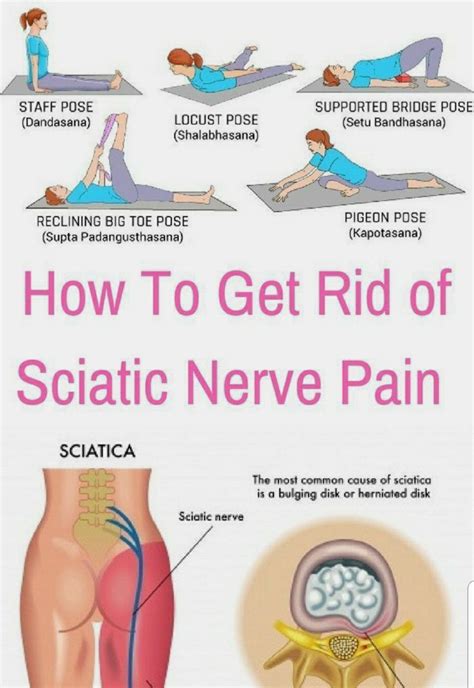 Sciatica Pain Relief, Sciatic Pain, Sciatic Nerve, Nerve Pain, Sciatica Exercises, Stretching ...