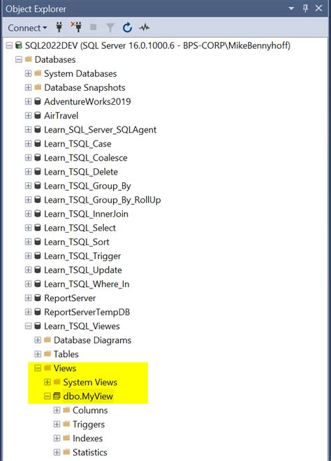 What Is a View in SQL Server 的图像结果
