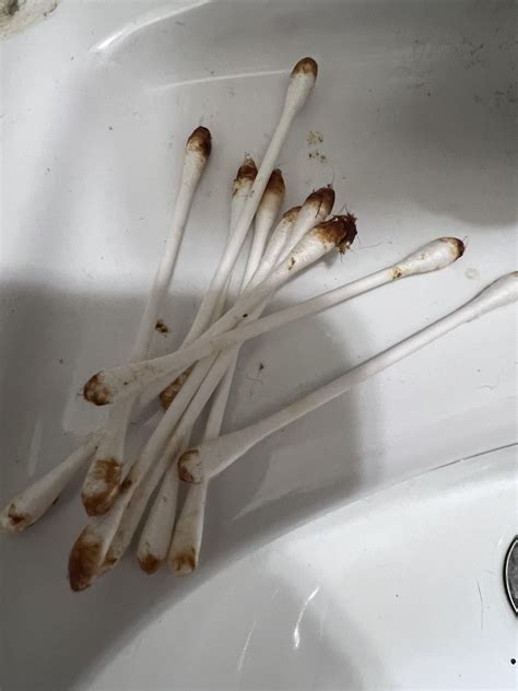 This is the first time my ear feels blocked with thickness : r/earwax