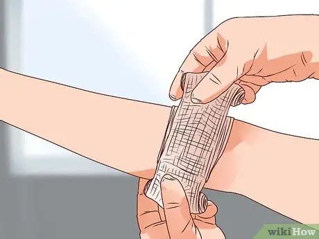 Image result for Open Fracture Surgery