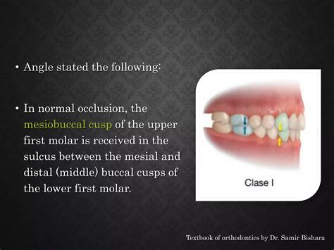 Class 2 Malocclusion