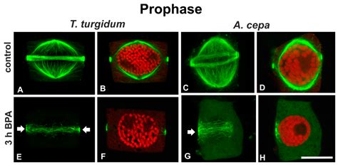 Tubulin Acetylation Mediates Bisphenol A Effects on the Microtubule ...