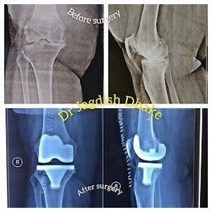 Asperia Speciality Clinic - Leading Orthopedic and Gynecological Care ...