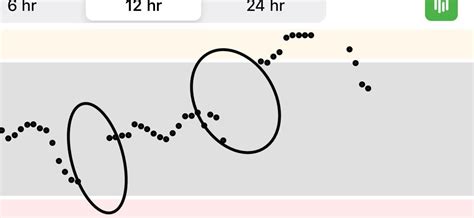 Image result for Dexcom Keeps Loosing Sensor Signal