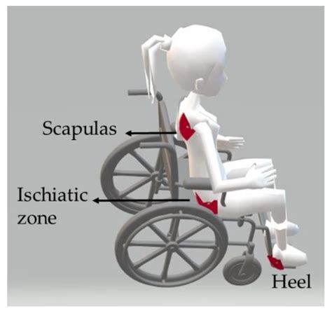 Wheelchair Pressure Ulcer Prevention Using FBG Based Sensing Devices