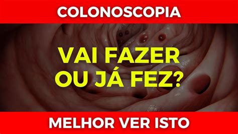Image result for Comparison of All Deep Learning Algorithm