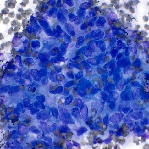 Cytology - AirClean Systems