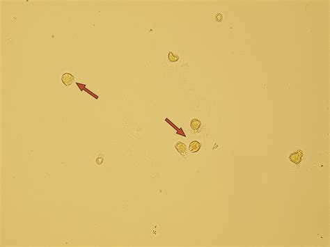 Renal Tubular Epithelial