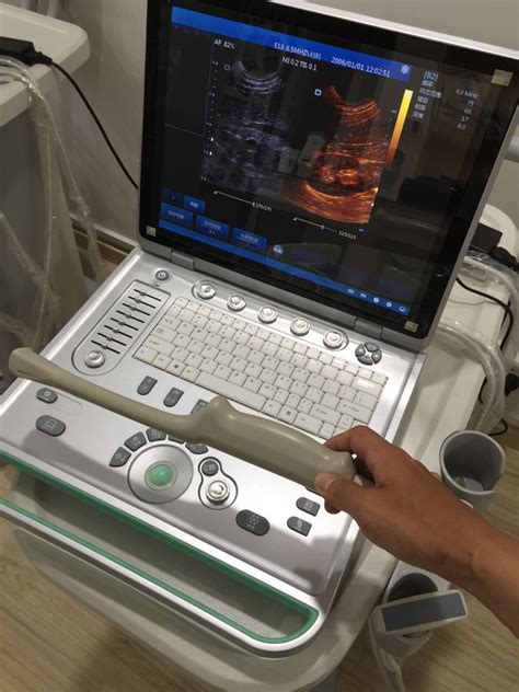 笔记本式B超机 便携式B超 超声波检测医用设备 B超兽用彩色B超-阿里巴巴