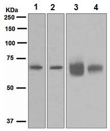 Anti-GRK6 antibody [EPR2046(2)] (AB109302) | Abcam, India