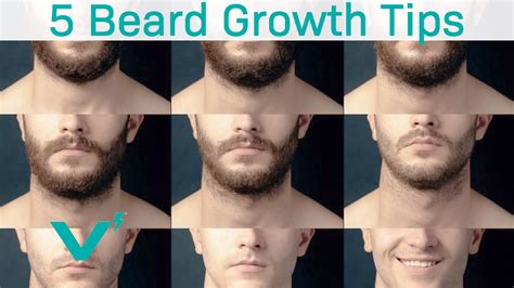 Growing A Beard: 5 Beard Growth Tips and Tricks