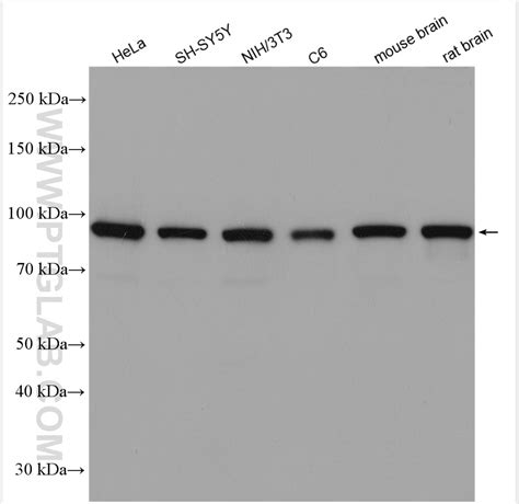 VCP antibody (10736-1-AP) | Proteintech