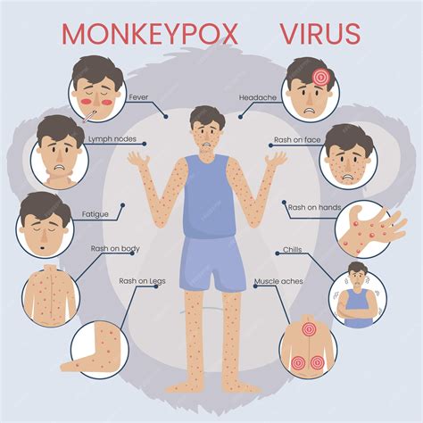 Premium Vector | Infographic concept of monkeypox virus 2022 The man is sick with smallpox and ...