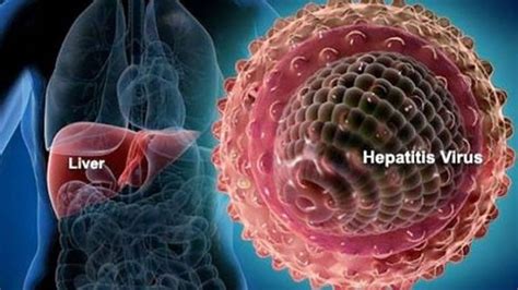 World Hepatitis Day: Hepatitis C Is 83% More Prevalent In North India ...