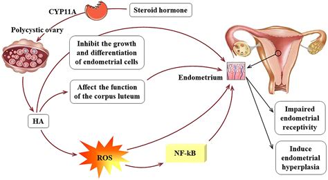 Frontiers | Research Progress on the Mechanism Between Polycystic Ovary Syndrome and Abnormal ...