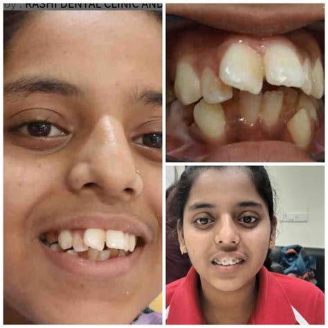 Dr. Dakaha's Rashi Dental Clinic - Smylist.in in Nagpur, India