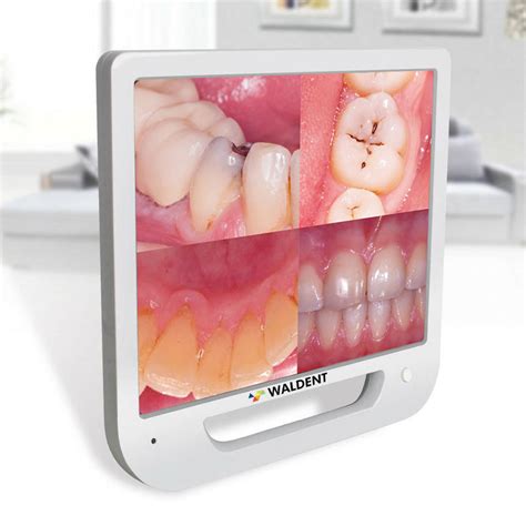 Waldent Intra Oral Camera with Screen - Ergo (10 MP) – Waldent.com